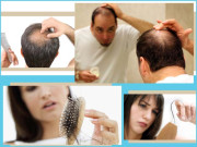 بالوں کو بھی غذا چاہیے ورنہ یہ گر جائیں گے