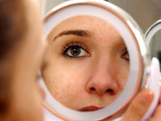 صحت  چہرے کے دانوں سے نجات ممکن ہے