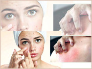 موسم برسات اور جلدی مسائل