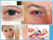 آشوب چشم ایک وبائی مرض