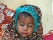 سندھ میں خسرہ سے رواں ماہ 14 بچے جاں بحق ہوگئے 