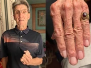 سمندر میں گم ہوجانے والی انگوٹھی 47 سال بعد مل گئی