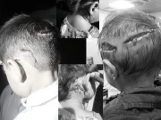 راولپنڈی میں آوارہ پاگل کتے کے حملے میں متعدد بچے زخمی