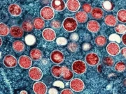 ایویئن انفلوئنزا وائرس سے پاکستان کی جنگلی حیات کو سنگین خطرات