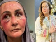 تشدد کیس، اداکارہ نرگس کے شوہر نے عبوری ضمانت حاصل کرلی