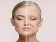 کم عمر لڑکیوں کے چہرے پر جھریاں پڑنے کی وجوہات اور علاج