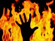 لاہور میں مذاق اور چھیڑ خانی کی وجہ سے لڑکوں نے 20 سالہ نوجوان پر پیٹرول ڈال کر آگ لگا دی
