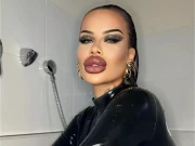 ماڈل نے ہونٹوں کی سرجری پر 50 ہزار پاؤنڈ خرچ کرڈالے