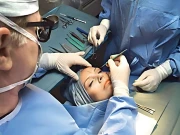 خوبصورتی کیلیے کاسمیٹک سرجری کروانے والی خواتین کیلیے ایران کا بڑا اعلان  