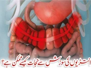 انتڑیوں کی سوزش سے نجات کیسے ممکن ہے؟