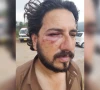 آزاد کشمیر؛ کالعدم کمیٹی کا تاجر رہنما پر مبینہ تشدد، نیم مردہ حالت میں پھینک کر فرار