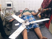 بھارت: اسپتال میں چھت سے پنکھا گرنے پر مریض ہلاک