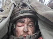 دماغ میں گولی لگنے کے باوجود لڑنے والا روسی سپاہی ہیرو قرار