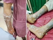 ناشتے کا بل مانگنے پر ملزم نے دکاندار کے بچوں پر گرم دودھ پھینک دیا، چاقو سے حملہ