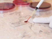 خون کے ٹیسٹ سے متعدد کینسرز کا قبل از وقت پتہ لگایا جاسکتا ہے، تحقیق