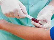 جگر کی بیماری کی قبل ازا وقت تشخیص کیلئے خون کا نیا ٹیسٹ وضع