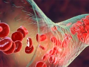 خون پتلا کرنے کیلئے ایسپرن سے بہتر دوا سامنے آگئی