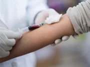 الزائمرز کی علامات کی تشخیص کیلئے خون کا نیا ٹیسٹ تیار