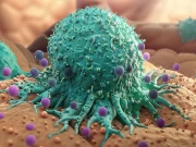 2050 تک 27 فیصد اموات کینسر سے ہوں گی، تحقیق