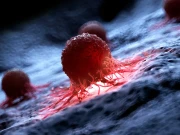 کینسر کی جلد تشخیص کیلئے ماہرین کی اہم تجویز!