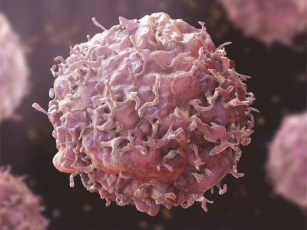 روزمرہ کے استعمال کی متعدد اشیاء کینسر کا سبب سن سکتی ہیں: تحقیق