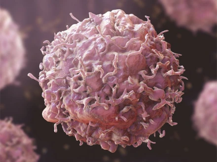 پروسٹیٹ کینسر کیلئے نئی دوا کی آزمائش