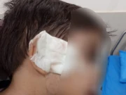 2 سالہ بچے کو سر پر چھرے مار کر زخمی کرنے والا گرفتار