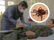 حیات آباد میڈیکل کمپلیکس میں کانگو وائرس کے متاثرہ دو مریض داخل