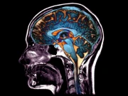 دماغ عمر کے کس حصے میں ’بوڑھا‘ ہوجاتا ہے؟