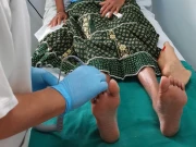 ذیابیطس میں پاؤں کاٹے جانے کے اکثر کیسز کو روکا جاسکتا ہے، ماہرین