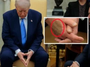 ٹانگوں میں سوجن اور ہاتھ پر نیل، صدر ٹرمپ کی صحت کے حوالے سے وائٹ ہاؤس کی پریس بریفنگ 