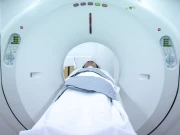 کیا سی ٹی اسکین کینسر کا خطرہ بڑھاتا ہے؟