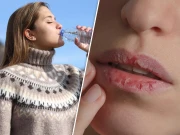 سردیوں میں ہونٹ خشک اور پیاس کیوں زیادہ لگتی ہے؟  احتیاطی تدابیر جانیے!