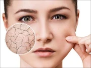 سردی میں چہرے کی رنگت ماند کیوں پڑ جاتی ہے؟ وجوہات اور قدرتی دیکھ بھال