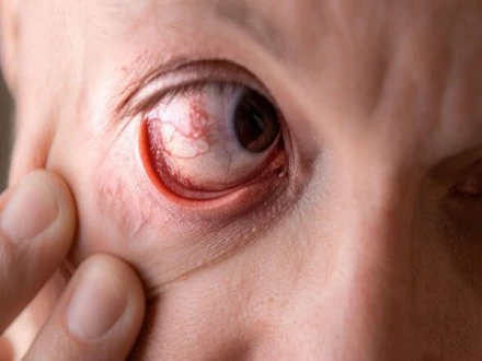 وزن کم کرنے کے انجیکشن سے اچانک بینائی جانے کا خطرہ بڑھ سکتا ہے: تحقیق