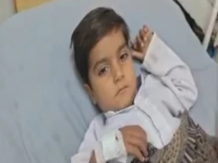 رحیم یار خان: بچے کے سینے سے ’بغیر سر والا بچہ‘ نکالنے کی انوکھی سرجری