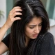 سر کی خشکی سے کیسے نجات پائیں؟ آسان گھریلو طریقے جانیں