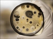 قاتل فنگس جو اندر سے انسان کو کھا جاتا ہے؛ نئی عالمی وبا کا خطرہ