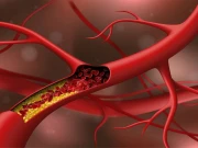 زیادہ کولیسٹرول کونسی دماغی بیماریوں کو جنم دے سکتا ہے؟