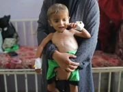غزہ میں بڑا انسانی المیہ، علاج نہ ملنے سے 1,500 سے زائد مریض دم توڑ گئے