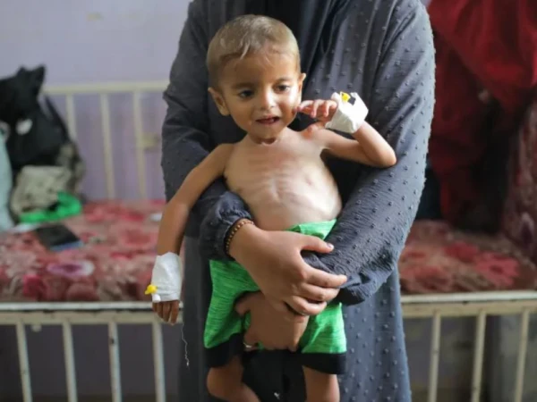 اسرائیلی فوج نے فلسطینی باپ کے سامنے 18 ماہ کے بچے کے جسم میں سگریٹ داغ دیے