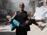 صیہونی افواج جان بوجھ کر بچوں کو نشانہ بنا رہی ہے، غیر ملکی طبی ماہرین کی رپورٹ میں انکشاف