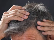 کم عمری میں بال سفید ہونے کی وجوہات سامنے آگئیں