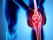 الٹرا پروسیسڈ غذائیں گھٹنے کی تکلیف کے امکانات میں اضافہ کر سکتی ہیں، تحقیق