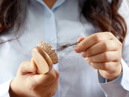 سردیوں میں بال گرنے سے پریشان ہیں تو یہ آزمودہ حل آپ ہی کیلیے ہے!