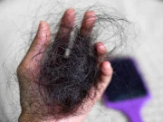 کیموتھراپی سے بال کھونے والے مریضوں کے لیے نیا جیل تیار