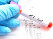 ایچ آئی وی کے علاج کی تلاش میں اہم کامیابی