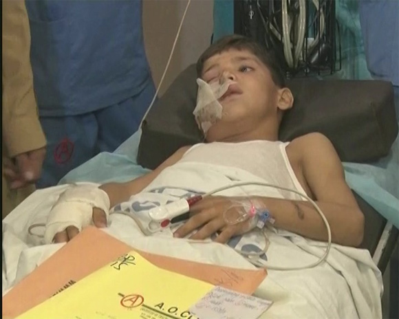 Karachi Child Adeel current injured Dr muhammad Ali shah treatment