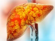 مصنوعی مٹھاس جگر کی مہلک بیماری کا سبب بن سکتی ہے: تحقیق