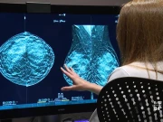 بریسٹ کینسر کو ابتدا میں ہی شناخت کرنے والا اے آئی بلڈ ٹیسٹ متعارف